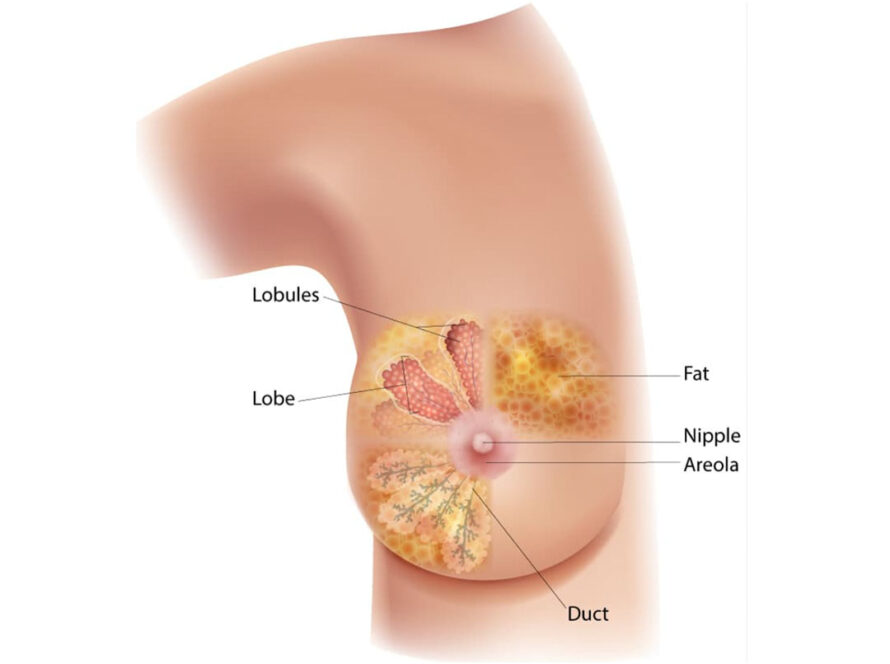 Breast Cancer Problems | Dr Dorai Ramanathan