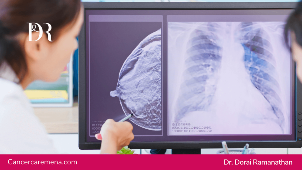 Breast Cancer Treatment | Dr Dorai Ramanathan