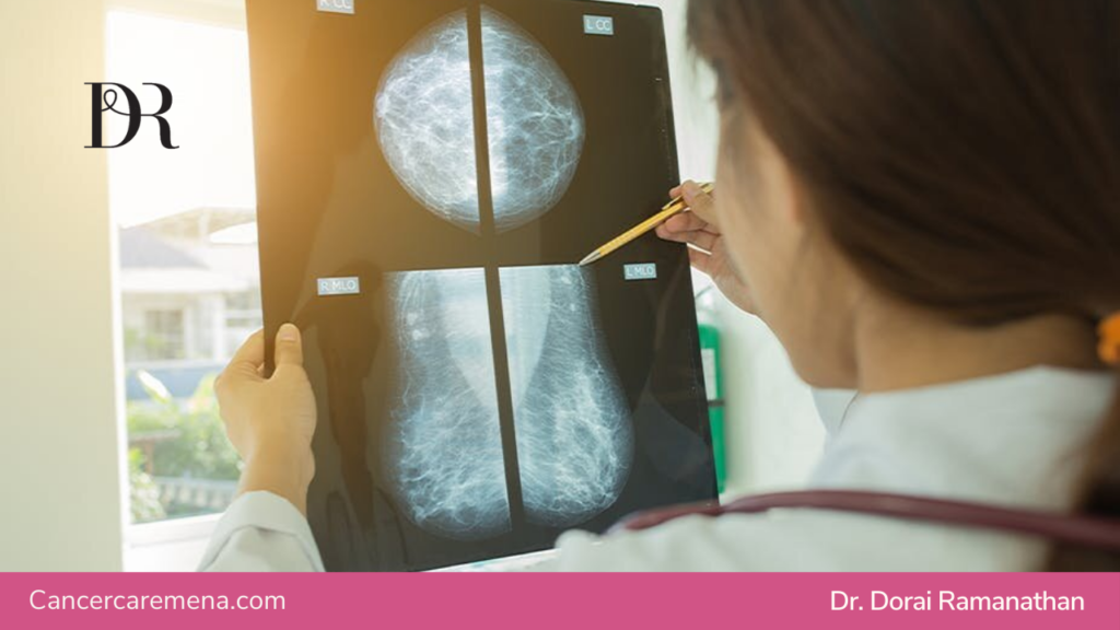 Breast Cancer Xray | Dr Dorai Ramanathan